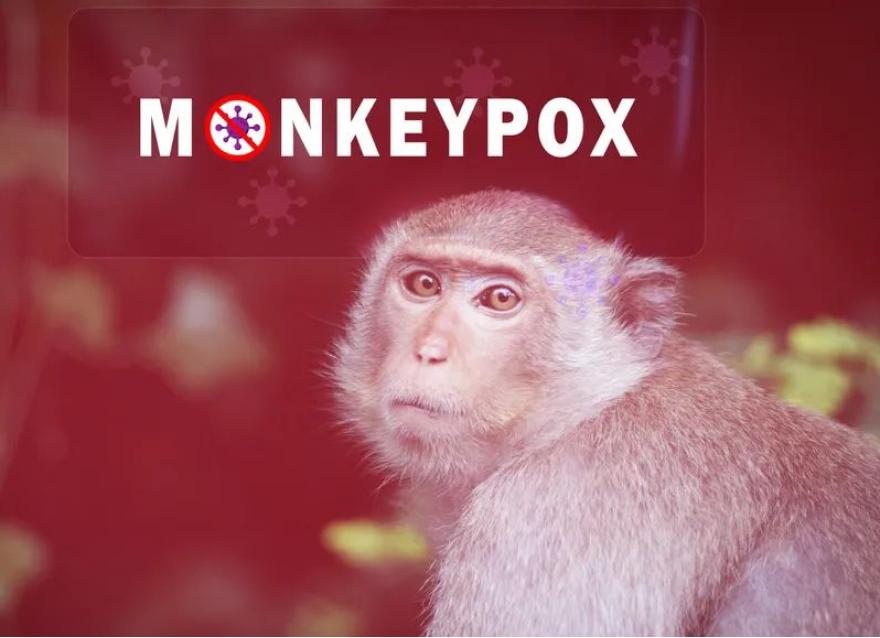 退退退！猴痘已入侵亞洲，糖友需警惕這些！